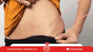 جلسات الليزر البارد للتخسيس بدون عملية|السعر|المميزات|نصائح