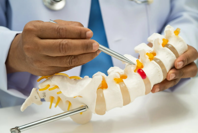 عرق النسا وعلاجه