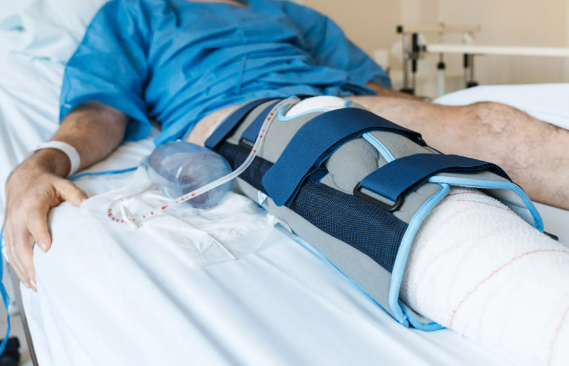 أفضل طرق تأهيل الرباط الصليبي ACL في مسقط لاستعادة قوة الركبة بسرعة