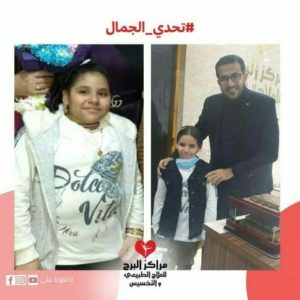 أسباب السمنة عند الأطفال